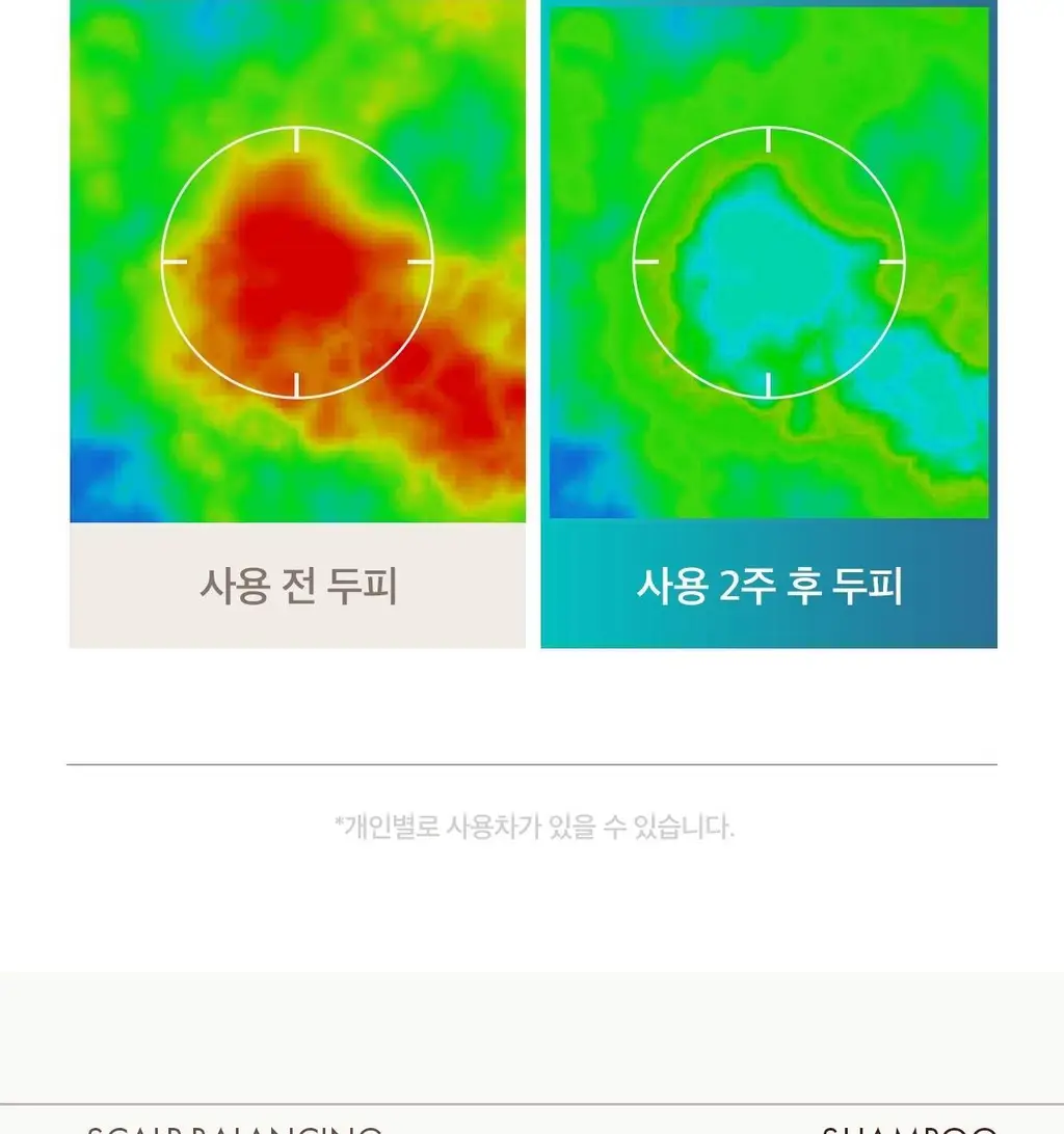 [두피 케어] 모로칸오일 스칼프 밸런싱 샴푸 250ml 상세페이지 9